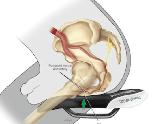 posición pelvis sillín genitales